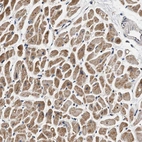 Anti-DCBLD2 Antibody