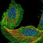 Immunofluorescent staining of human cell line U-2 OS shows localization to plasma membrane & cytosol.