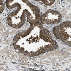 Anti-HEBP2 Antibody