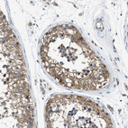 Anti-PANX1 Antibody