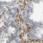 Immunohistochemical staining of human prostate shows moderate cytoplasmic positivity in smooth muscle cells.
