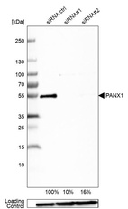 Western blot analysis in U-138MG cells transfected with control siRNA, target specific siRNA probe #1 and #2, using Anti-PANX1 antibody. Remaining relative intensity is presented. Loading control: Anti-GAPDH.