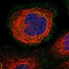 Immunofluorescent staining of human cell line A-431 shows localization to plasma membrane.