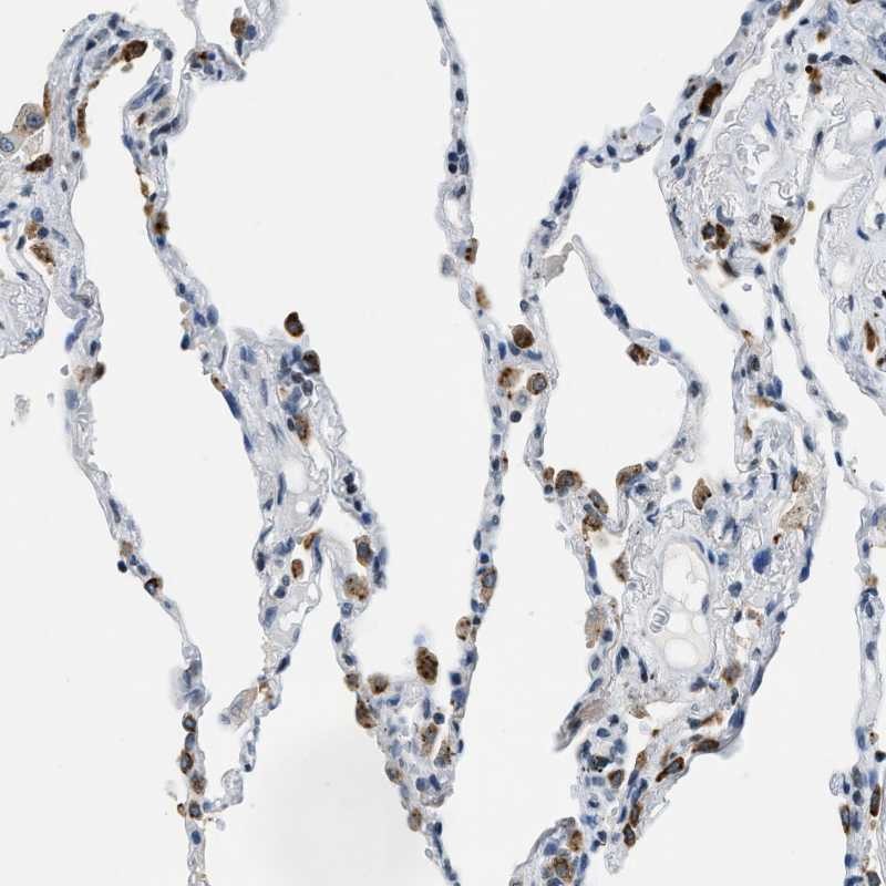 Anti-UVRAG Antibody
