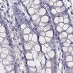 Immunohistochemical staining of human colon using Anti-C16orf89 antibody HPA016934.