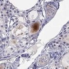 Immunohistochemical staining of human thyroid gland using Anti-C16orf89 antibody HPA016934.