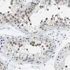 Anti-PITHD1 Antibody