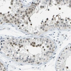 Anti-PITHD1 Antibody