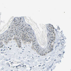 Immunohistochemical staining of human skin shows moderate positivity in nucleoli in squamous epithelial cells.