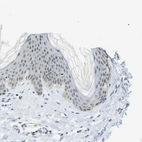 Immunohistochemical staining of human skin shows moderate positivity in nucleoli in squamous epithelial cells.