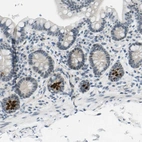 Immunohistochemical staining of human small intestine shows strong cytoplasmic positivity in Paneth cells.