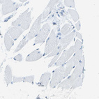 Anti-PITHD1 Antibody