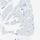 Immunohistochemical staining of human skeletal muscle shows no positivity in myocytes as expected.