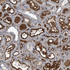 Anti-ATP6V0D1 Antibody