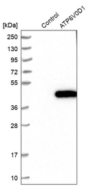 Western blot analysis in control (vector only transfected HEK293T lysate) and ATP6V0D1 over-expression lysate (Co-expressed with a C-terminal myc-DDK tag (~3.1 kDa) in mammalian HEK293T cells, LY417820).