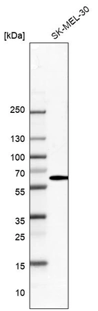 Western blot analysis in human cell line SK-MEL-30.