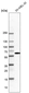 Anti-SARS Antibody