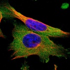 Immunofluorescent staining of human cell line U-251 MG shows localization to cytosol.