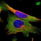 Immunofluorescent staining of human cell line U-251 MG shows localization to cytosol.