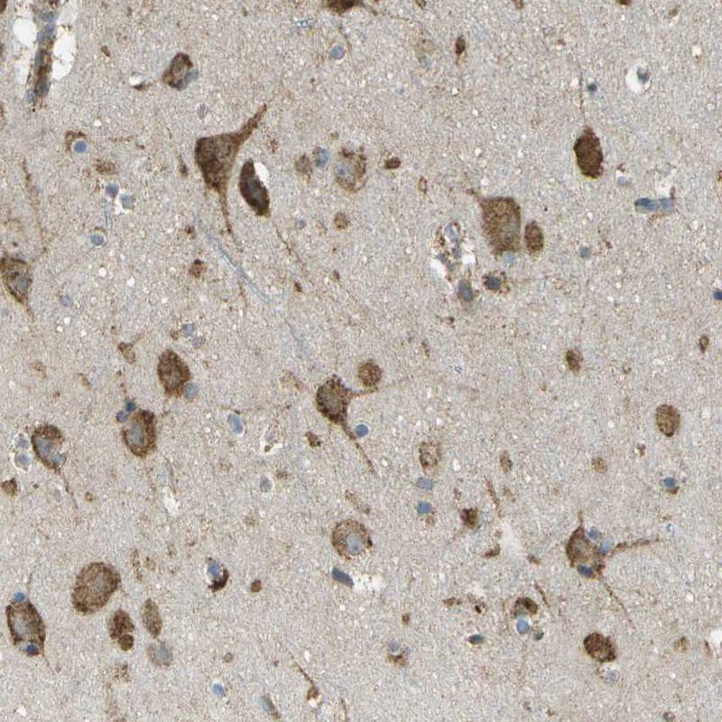 Anti-USP30 Antibody