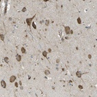 Anti-USP30 Antibody