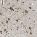 Anti-USP30 Antibody