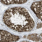 Immunohistochemical staining of human testis shows moderate to strong cytoplasmic positivity in cells in seminiferous ducts and in Leydig cells.