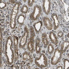 Immunohistochemical staining of human kidney shows moderate to strong cytoplasmic positivity in renal tubules cells.
