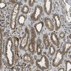 Anti-USP30 Antibody