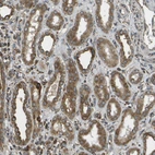 Immunohistochemical staining of human kidney shows moderate to strong cytoplasmic positivity in renal tubules cells.