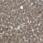 Immunohistochemical staining of human liver shows moderate cytoplasmic positivity in hepatocytes.
