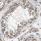Immunohistochemical staining of human testis shows moderate nuclear positivity in cells in seminiferous ducts.