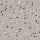 Immunohistochemical staining of human cerebral cortex shows moderate nuclear positivity in neurons.