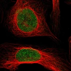 Immunofluorescent staining of human cell line U-2 OS shows localization to nucleoplasm.