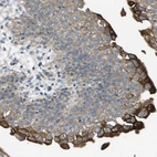 Anti-KRT23 Antibody