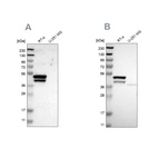 Western blot analysis using Anti-KRT23 antibody HPA016959 (A) shows similar pattern to independent antibody HPA012050 (B).