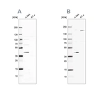 Western blot analysis using Anti-GALK1 antibody HPA016960 (A) shows similar pattern to independent antibody HPA007094 (B).