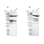 Western blot analysis using Anti-EIF4G2 antibody HPA016965 (A) shows similar pattern to independent antibody HPA006773 (B).