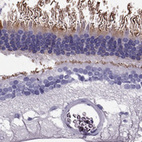 Immunohistochemical staining of human eye, retina shows moderate positivity in rods.