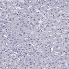 Anti-PDE6A Antibody