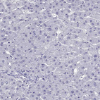 Immunohistochemical staining of human liver shows no positivity in hepatocytes as expected.