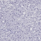 Immunohistochemical staining of human liver shows no positivity in hepatocytes as expected.