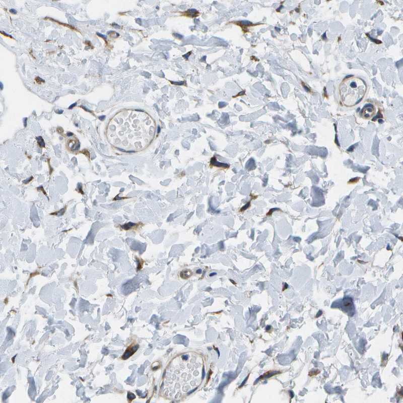 Anti-P3H1 Antibody