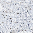 Anti-P3H1 Antibody