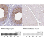 Anti-P4HA2 Antibody