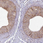 Immunohistochemical staining of human epididymis shows high expression.
