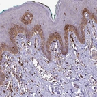 Immunohistochemical staining of human skin shows strong cytoplasmic positivity in squamous epithelial cells.