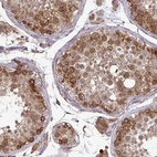 Immunohistochemical staining of human testis shows strong cytoplasmic positivity in cells in seminiferous ducts.