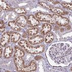 Immunohistochemical staining of human kidney shows strong cytoplasmic positivity in cells in tubules.