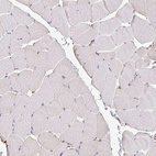Immunohistochemical staining of human skeletal muscle shows no positivity in myocytes as expected.